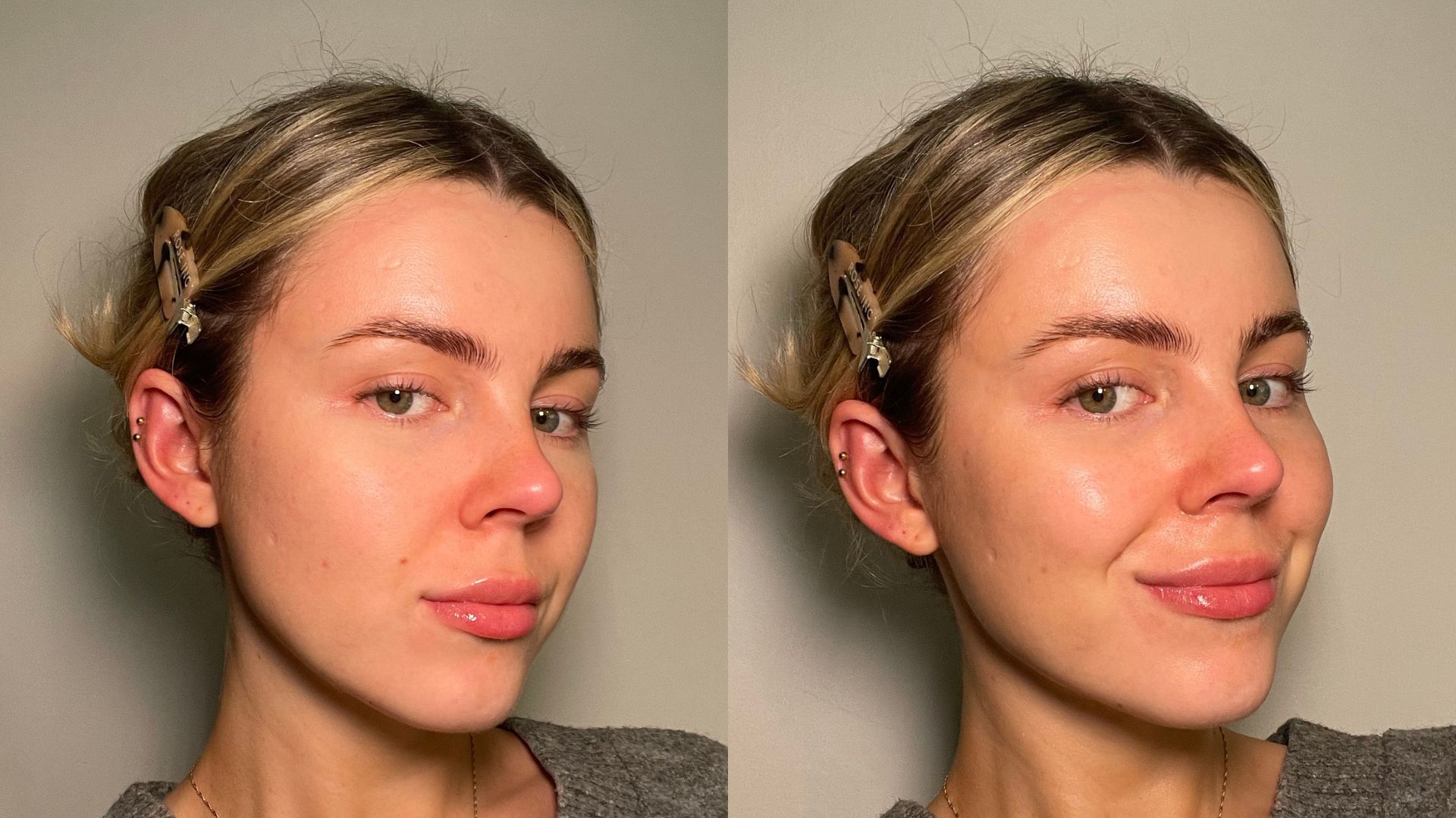 Elemis Pro Marine Collagen Cream Freya Before And After